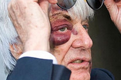 Ecclestone sfrutta l'aggressione per una pubblicità!