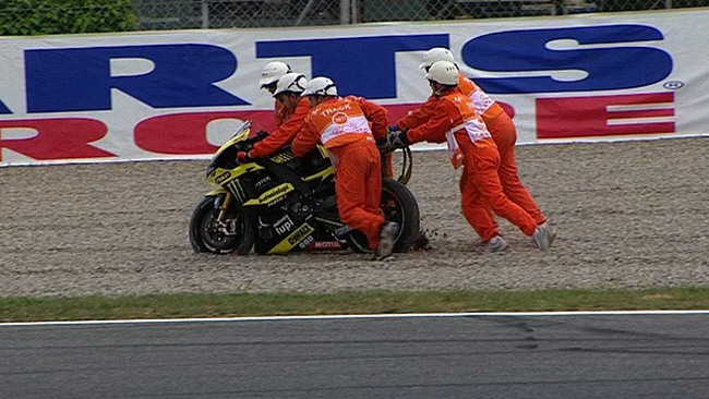 Frattura della clavicola destra per Edwards