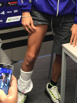 Valentino Rossi shows his leg